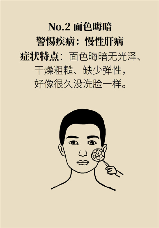 臉上的9個變化分別警示什么病？快對鏡自查