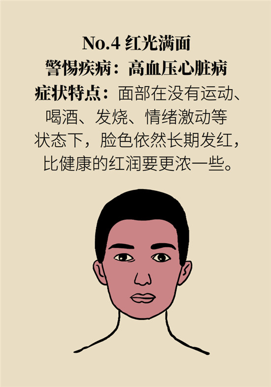 臉上的9個變化分別警示什么??？快對鏡自查