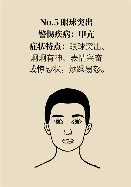 臉上的9個變化分別警示什么病？快對鏡自查
