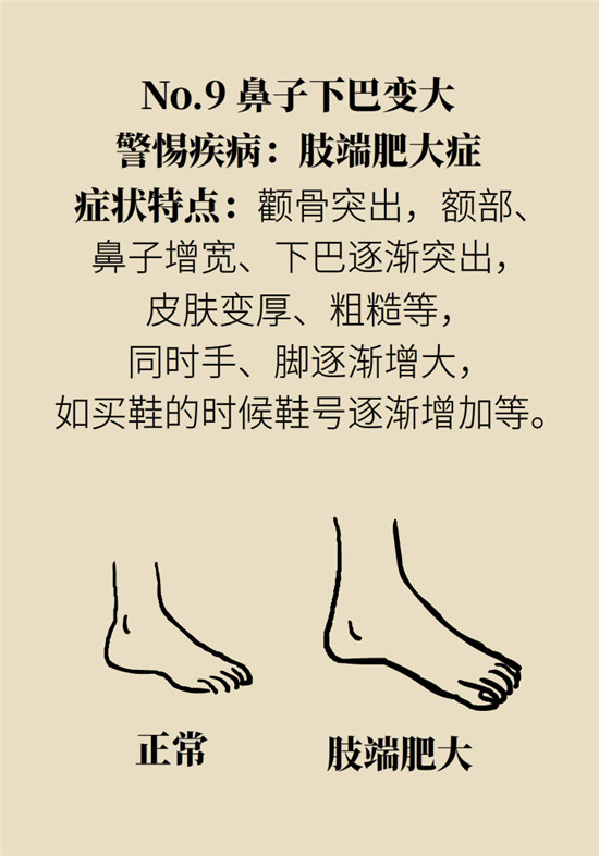 臉上的9個變化分別警示什么??？快對鏡自查