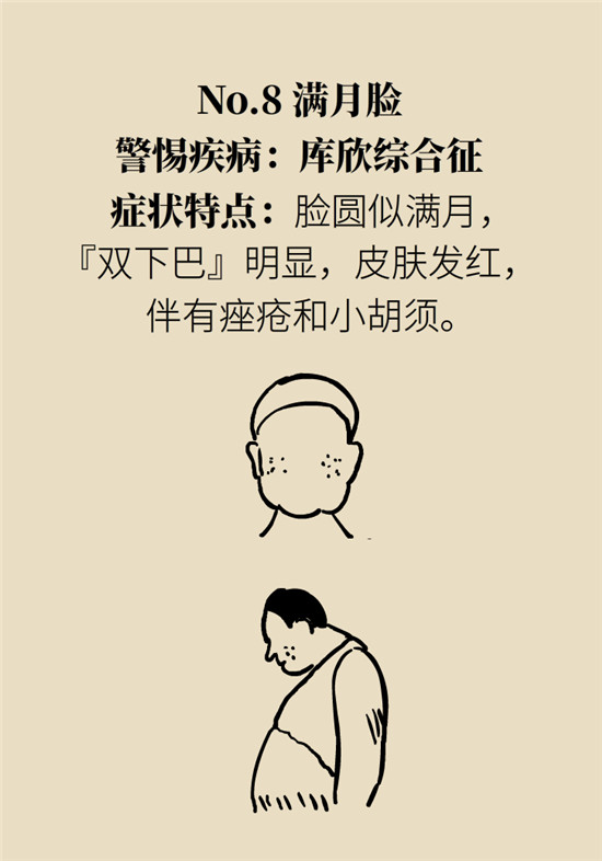 臉上的9個變化分別警示什么?。靠鞂︾R自查