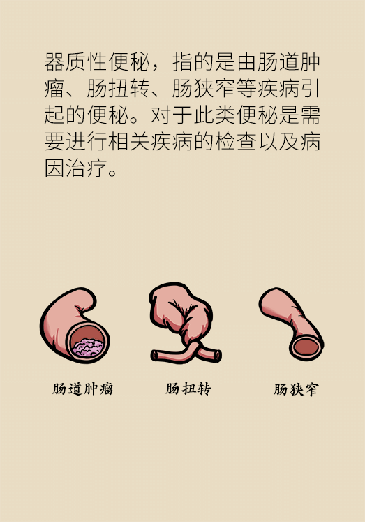 香蕉真的會緩解便秘嗎？