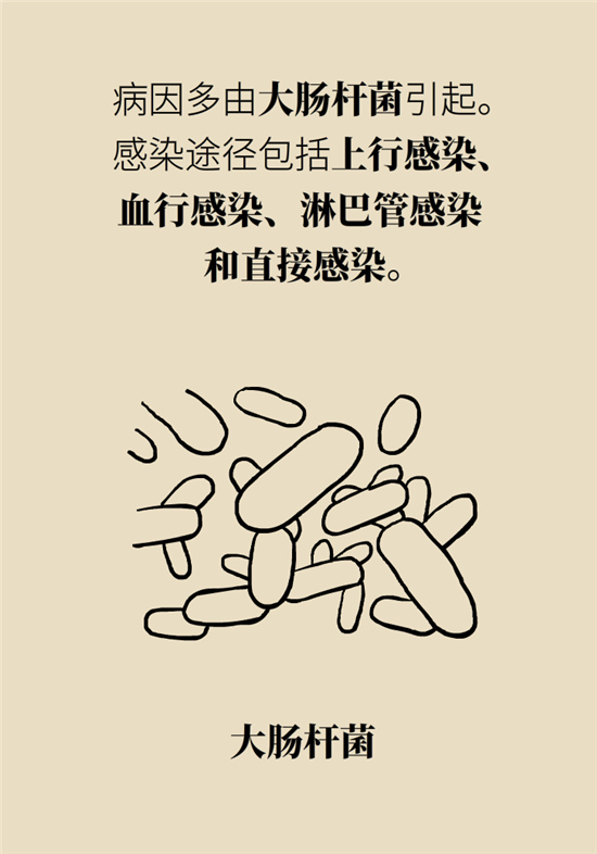 經常憋尿會得急性腎炎？