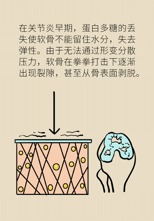 人老關節(jié)也會老嗎？