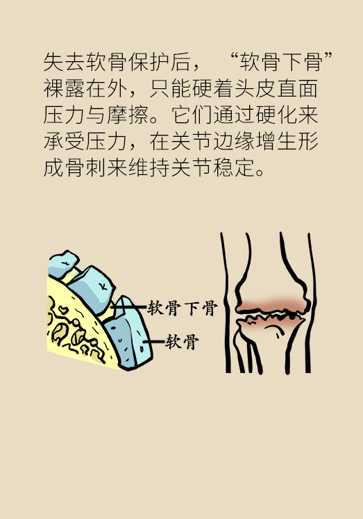 人老關節(jié)也會老嗎？