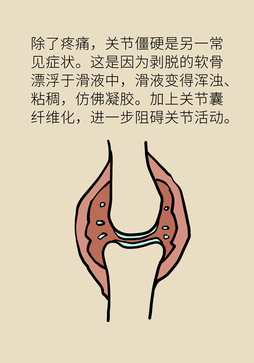 人老關節(jié)也會老嗎？