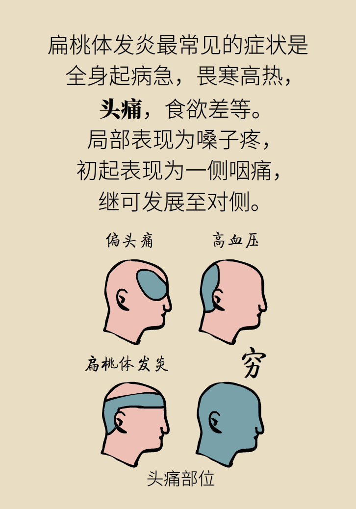 單側(cè)扁桃體腫大更兇險(xiǎn)！謹(jǐn)防惡性腫瘤