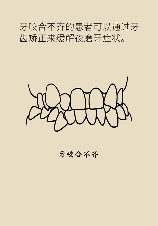 牙齒科普動漫 磨牙