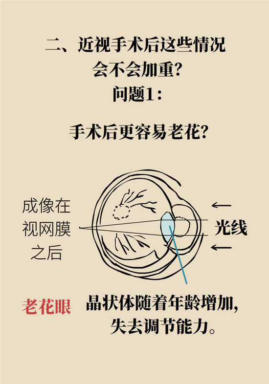 近視科普動(dòng)漫制作 近視