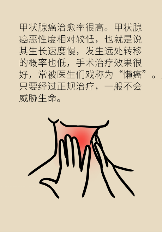 甲狀腺結(jié)節(jié)離癌有多遠(yuǎn) 甲狀腺科普動漫制作