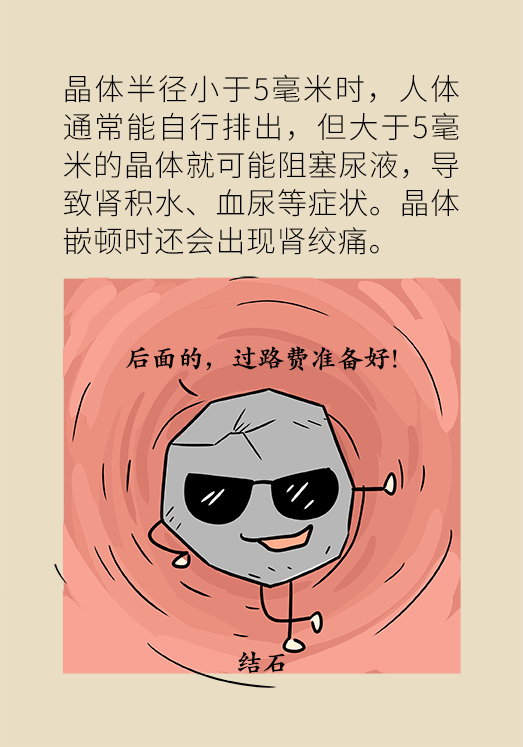 結(jié)石科普動(dòng)漫制作 結(jié)石科普動(dòng)漫制作