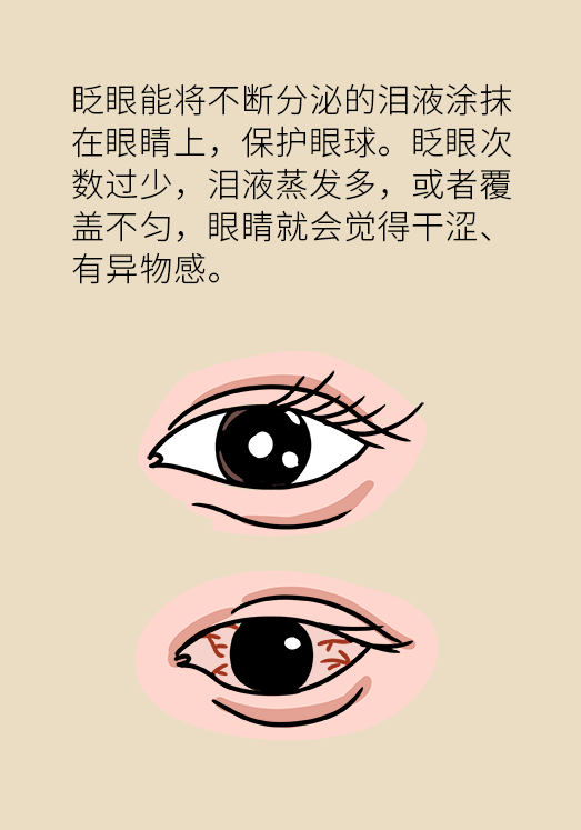 熬夜追劇后眼睛干澀疼痛？