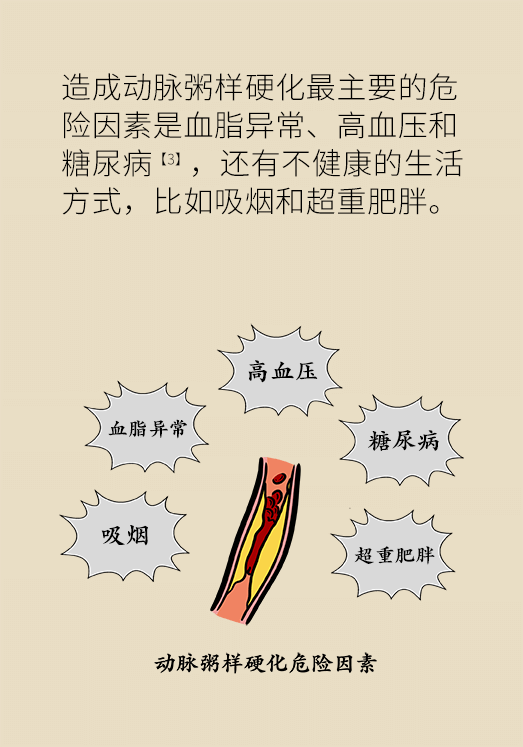 心梗科普動(dòng)漫制作