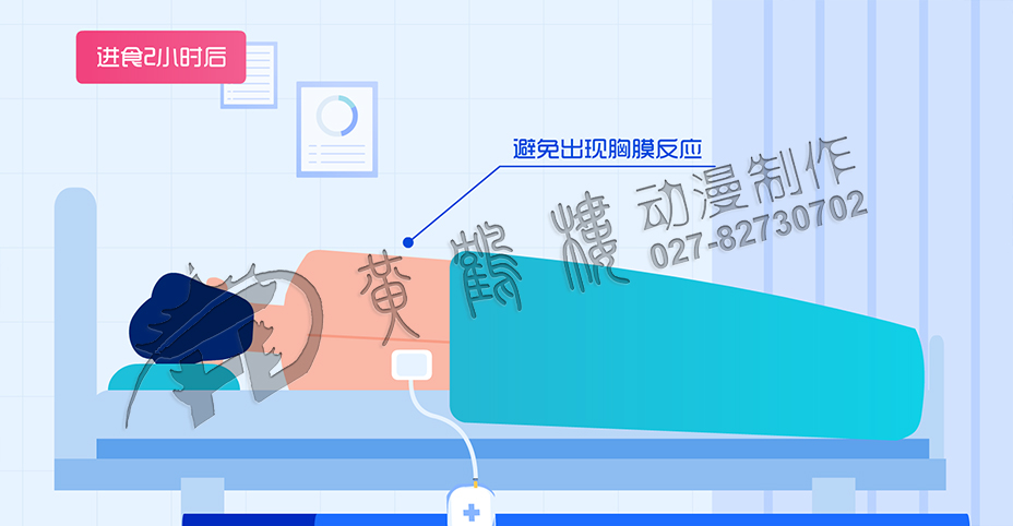 醫(yī)學(xué)動(dòng)畫制作公司 醫(yī)學(xué)動(dòng)畫制作公司