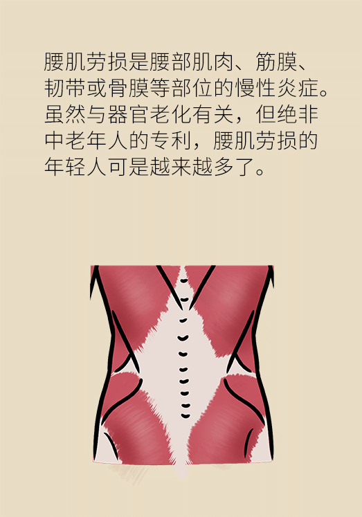 久坐久站致腰肌勞損？六招教你戰(zhàn)勝腰痛