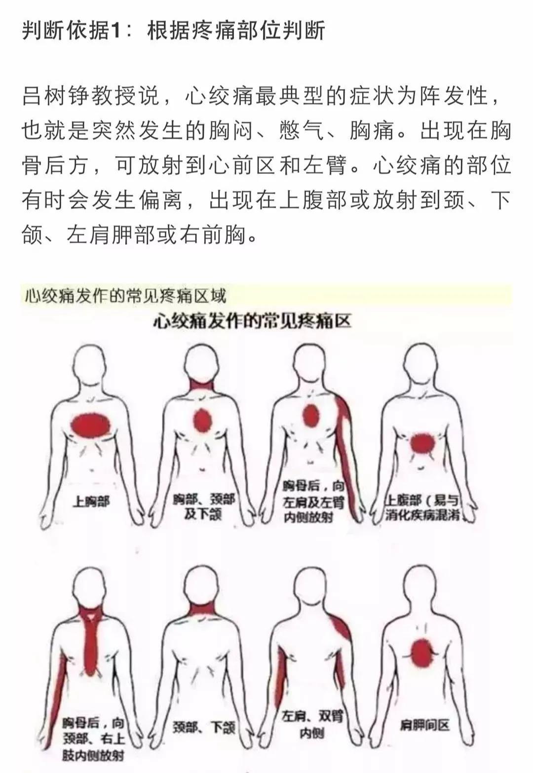 心梗有前兆！心臟發(fā)出的警報(bào)你在意了嗎？