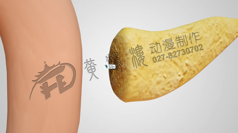 武漢醫(yī)療動畫制作.jpg 武漢醫(yī)療動畫制作.jpg