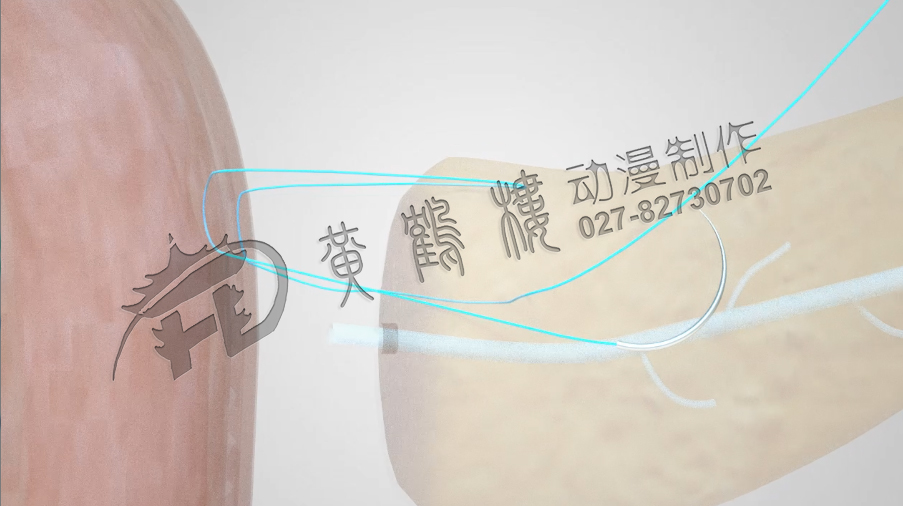 武漢醫(yī)療動畫演示制作公司.jpg 武漢醫(yī)療動畫演示制作公司.jpg
