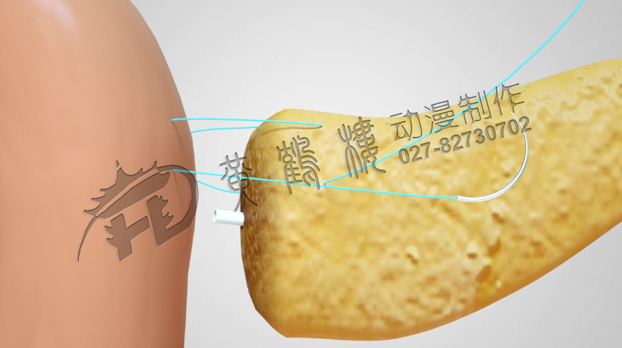 武漢醫(yī)學制作動畫公司.jpg 武漢醫(yī)學制作動畫公司.jpg