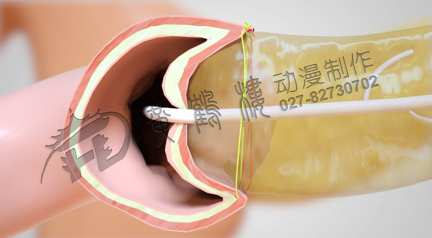 武漢制作醫(yī)療動畫公司.jpg 武漢制作醫(yī)療動畫公司.jpg