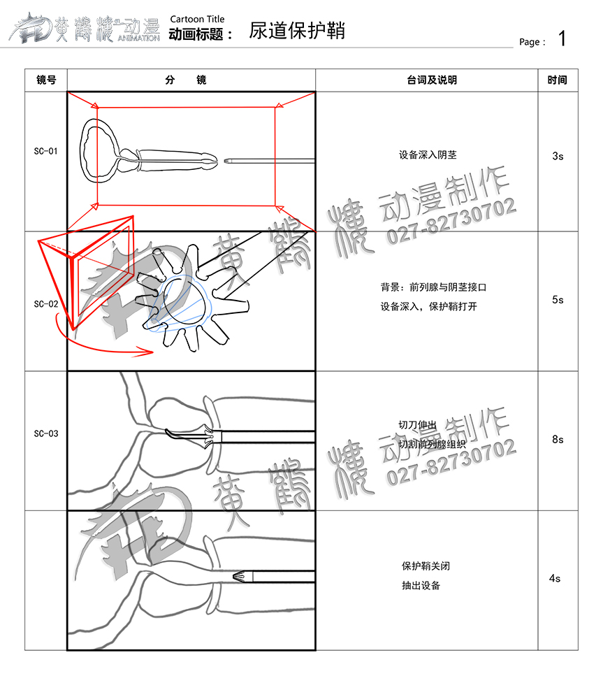 尿道保護(hù)鞘分鏡頭設(shè)計 尿道保護(hù)鞘分鏡頭設(shè)計