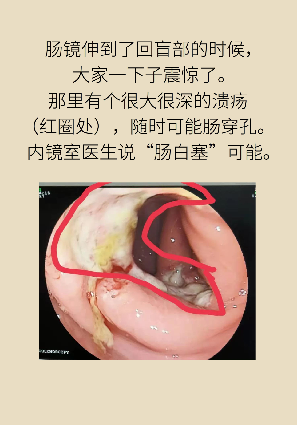 長白塞病醫(yī)學(xué)知識科普動(dòng)畫制作