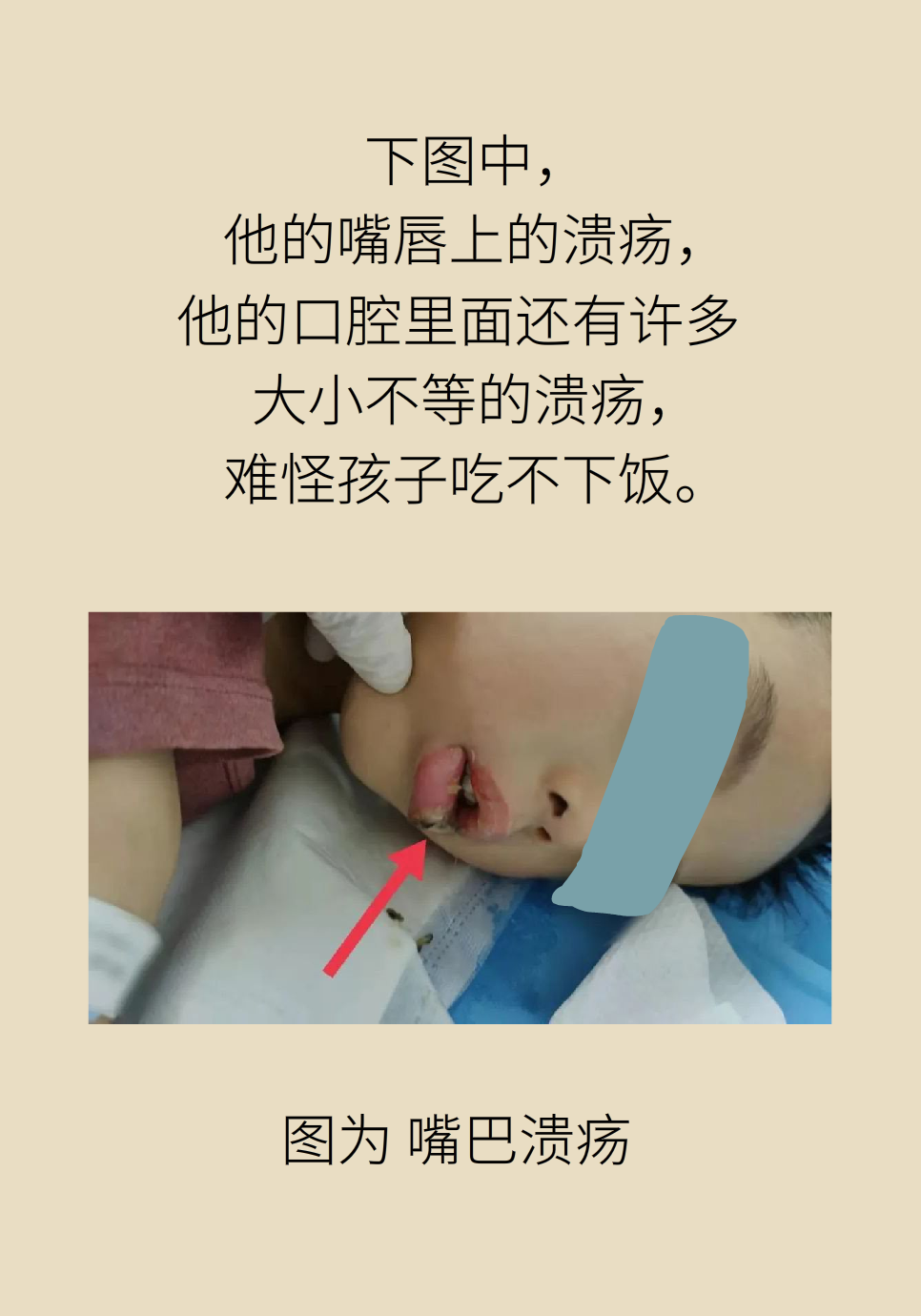 長白塞病醫(yī)學(xué)知識科普動(dòng)畫制作