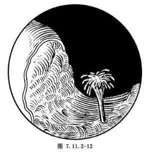 經(jīng)尿道前列腺切除術