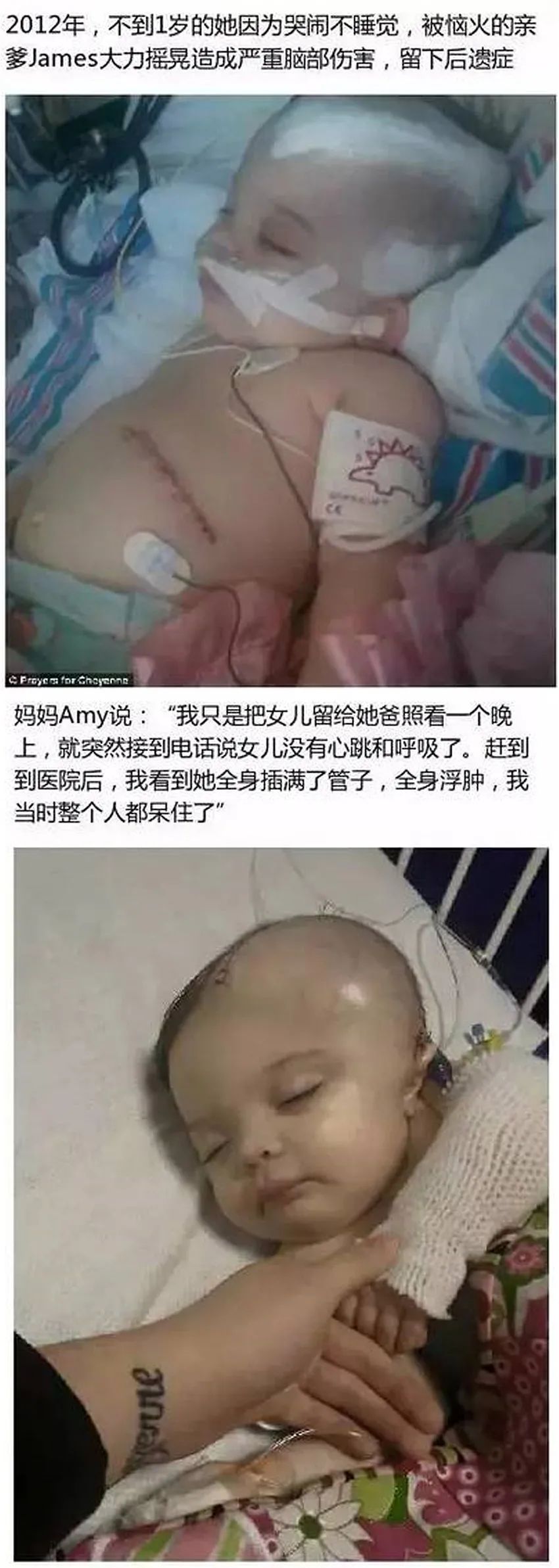 育兒醫(yī)學(xué)科普:大力搖晃會(huì)損傷寶寶的大腦致腦損傷