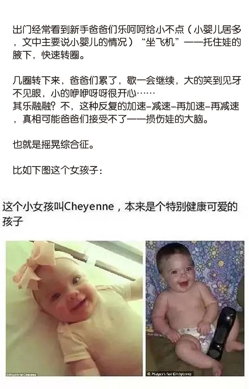 育兒醫(yī)學(xué)科普:大力搖晃會(huì)損傷寶寶的大腦致腦損傷