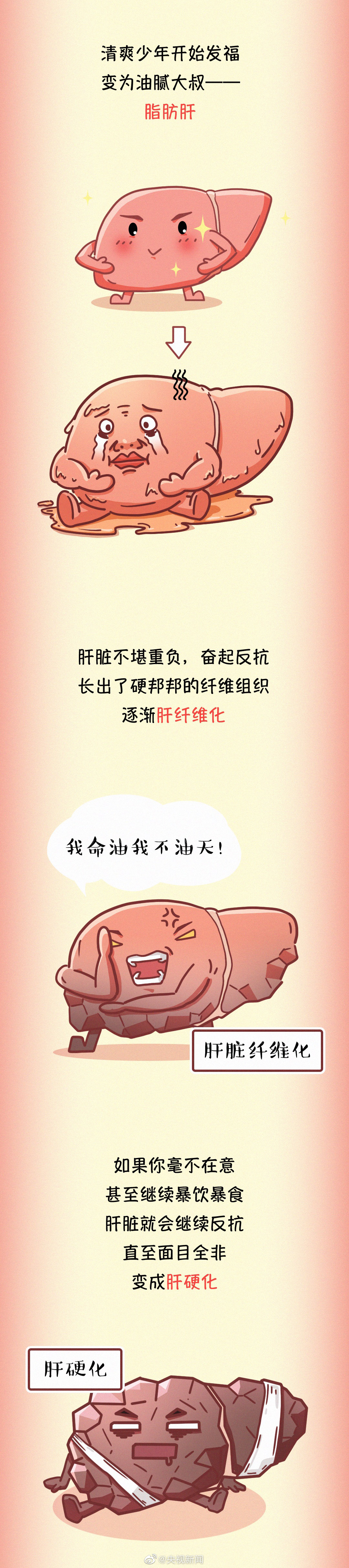 肝臟疾病醫(yī)學科普：常見傷肝行為有哪些？04.jpg