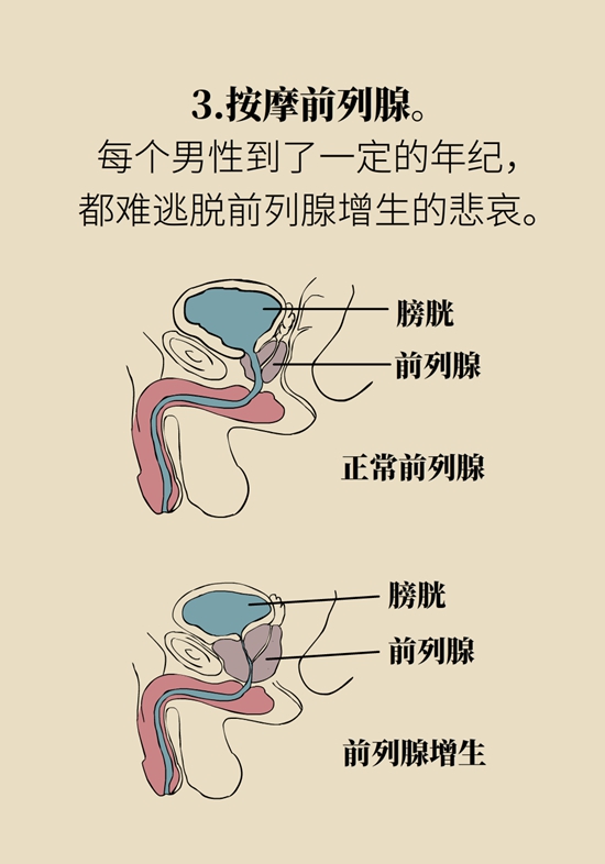 怎么做可以預(yù)防痔瘡呢？按摩前列腺、鍛煉盆底肌