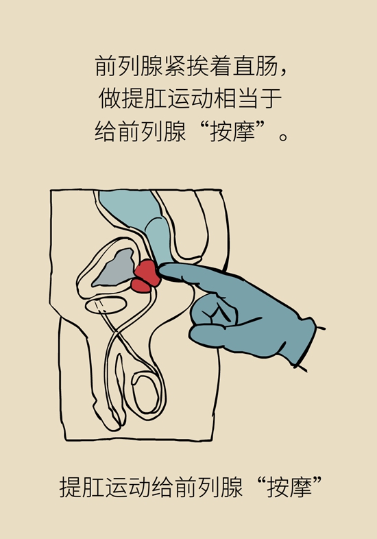 怎么做可以預(yù)防痔瘡呢？按摩前列腺、鍛煉盆底肌