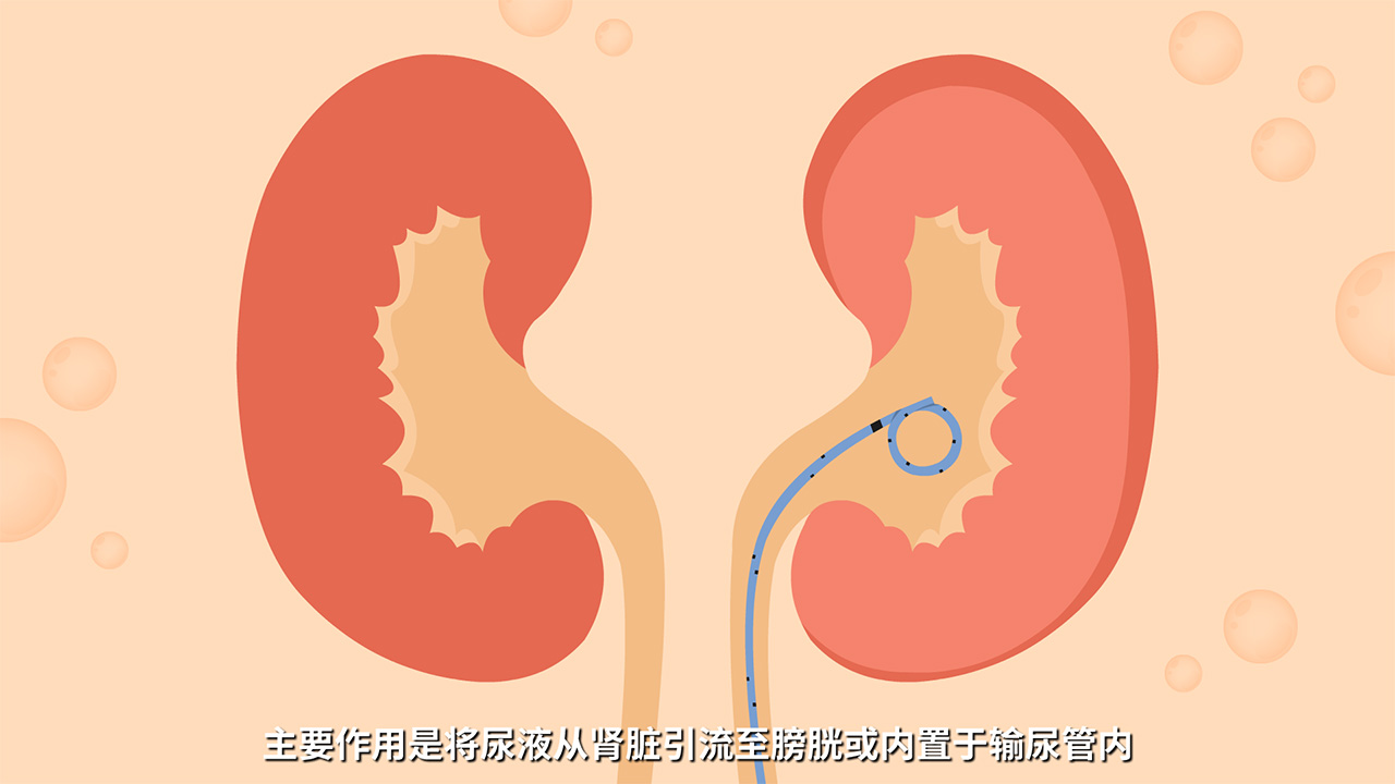 醫(yī)療動(dòng)畫(huà)視頻如何制作.jpg