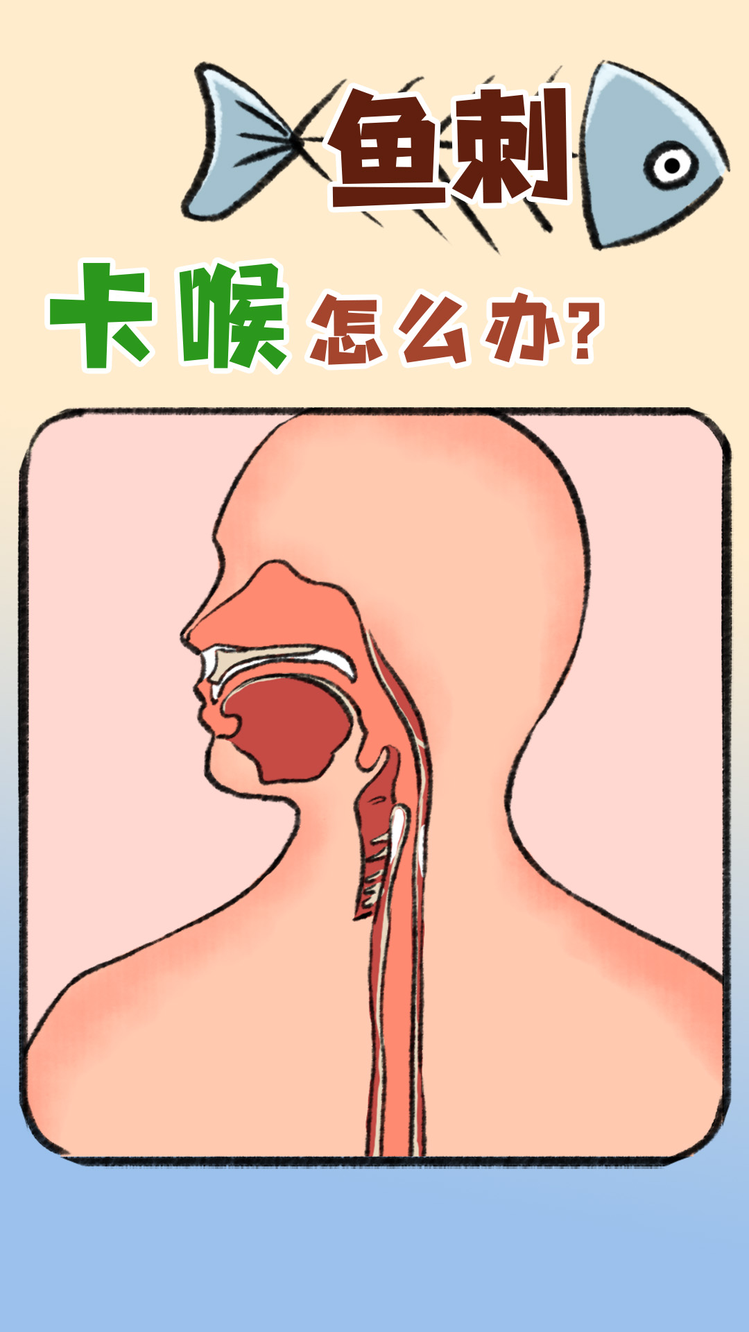 33魚(yú)刺咔喉怎么辦標(biāo)題0328(1).jpg